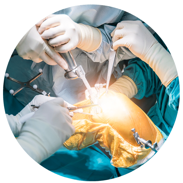 Minivasive Pain Knee Surgery