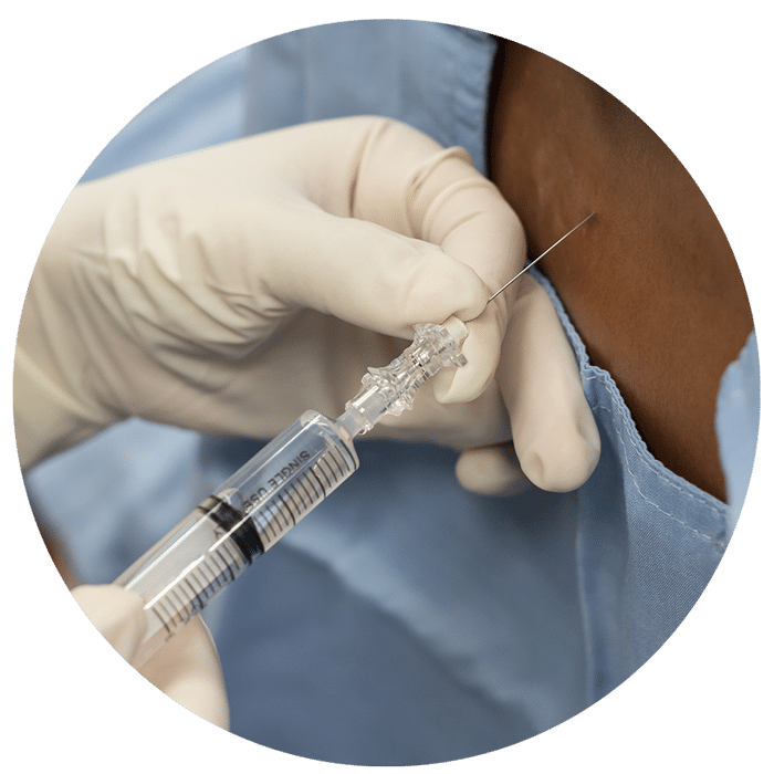 Minivasive Pain and Orthopedics ACL