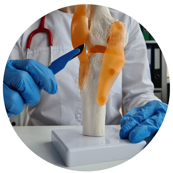 Minivasive-ACL-Knee-Repair-1 Doctor Pointing at Knee Model